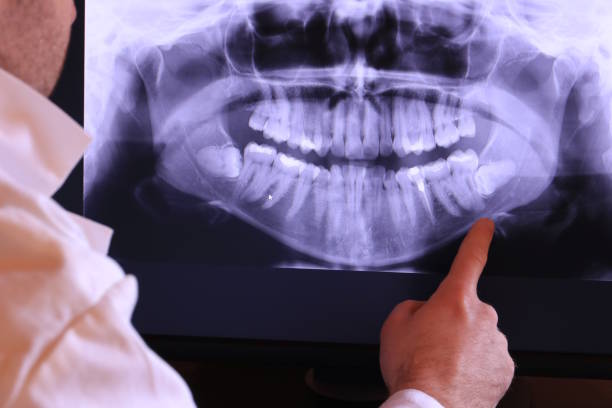 Trusted VT Emergency Dentist Experts
