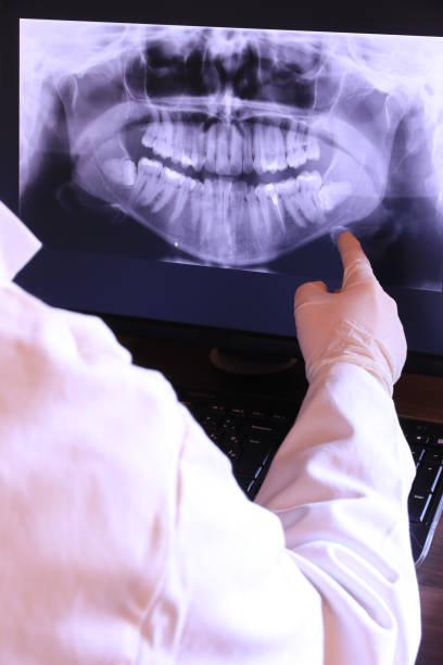 Best Broken or Cracked Tooth Emergency Dentist in Morrisville, VT
