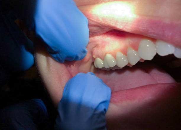 Best Pediatric Emergency Dentist in Morrisville, VT